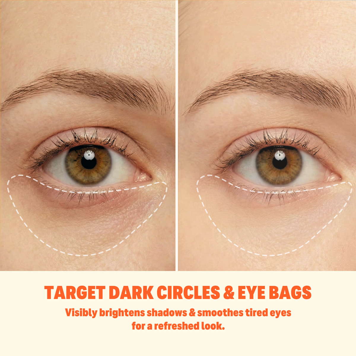Why Your Eyes Look Tired After Screens and Late Nights (and How to Look More Awake)